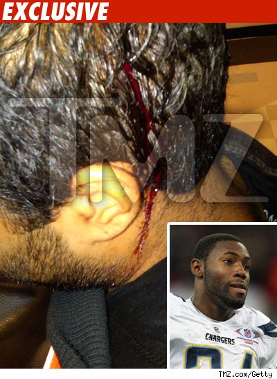 NFL Star Investigation -- The Bloody Damage