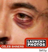 Hugh Laurie Took a Shot to the Face