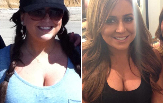 "Real Housewives" Star Lauren Manzo Gets Breast Reduction