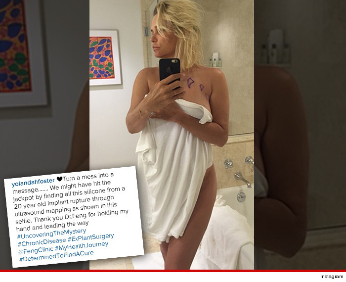 How Did Yolanda Know She Had Lymes Disease | yolanda foster i removed my leaky breast implants tmz com How Did Yolanda Know She Had Lymes Disease | yolanda foster i removed my leaky breast implants tmz com