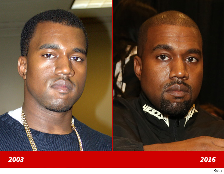 Kanye West Good Genes or Good Docs?