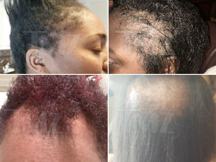 L'Oreal SoftSheen Hair Relaxers Should Be Recalled, Lawyers Demand (PHOTO GALLERY)