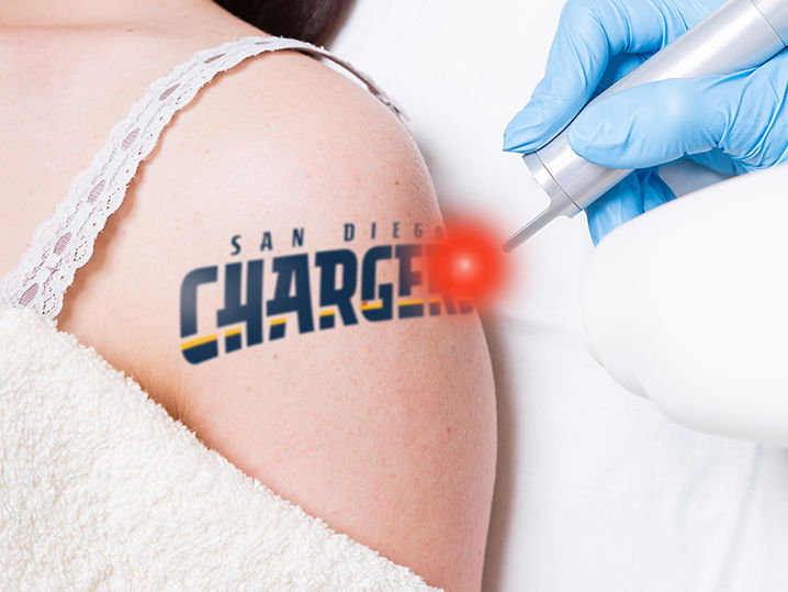 scorned chargers fans offered free tattoo removal tmz com scorned chargers fans offered free tattoo removal tmz com