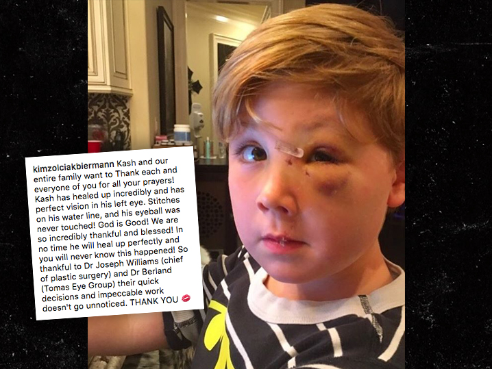 zolciak bit by zolciak posts photo of kash s injured post bite tmz zolciak bit by zolciak posts photo of kash s injured post bite tmz